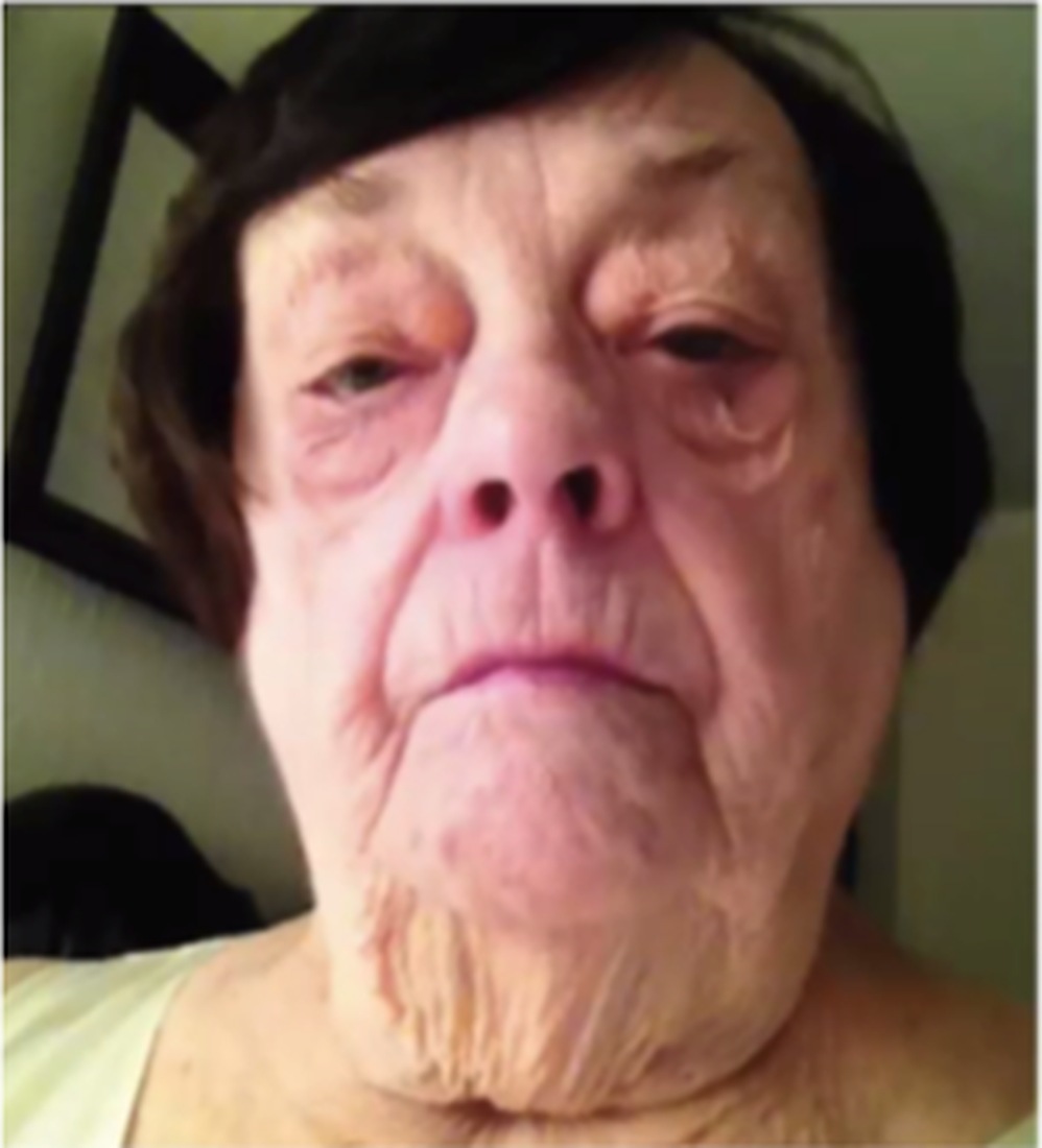 Before, age 84