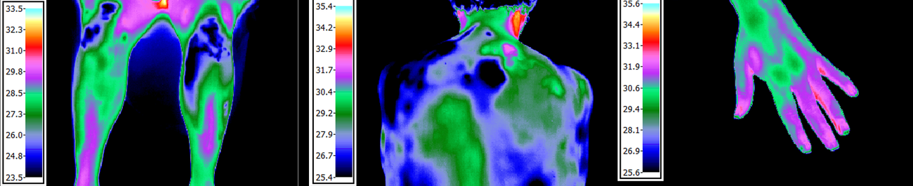 Thermography, fifteen minutes later