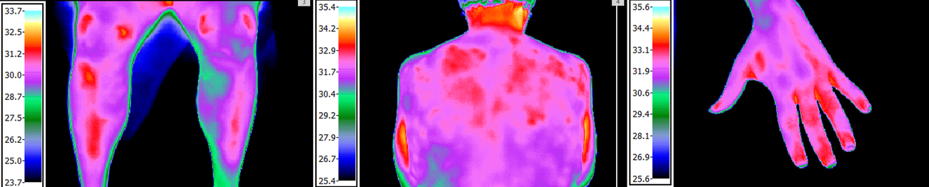 Thermography, baseline